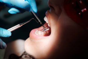 7 Signs You Need to See Your Dentist | Klamath Smiles