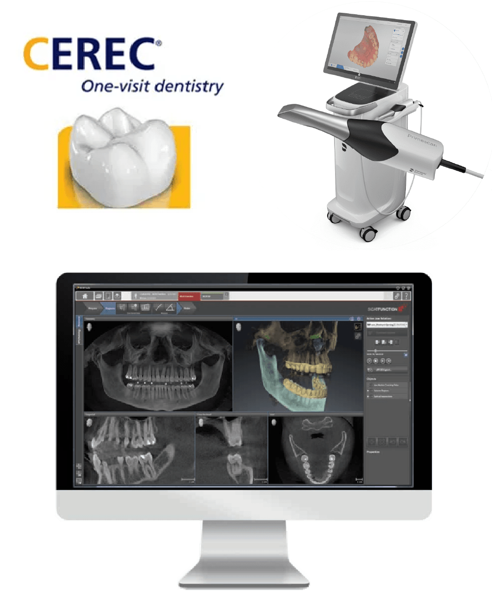 Cerec Same day crowns, prime scan dental scans, and 3D dental x-rays